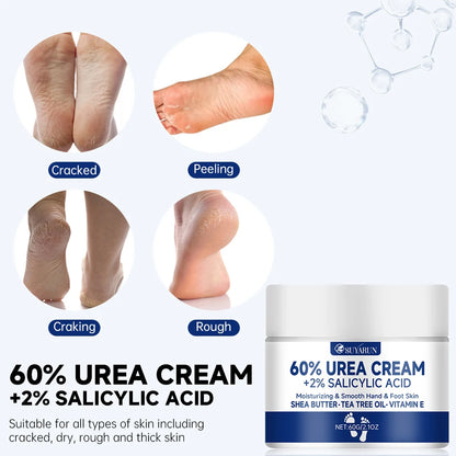 60% Urea Foot Cream for Dry & Cracked Heels
