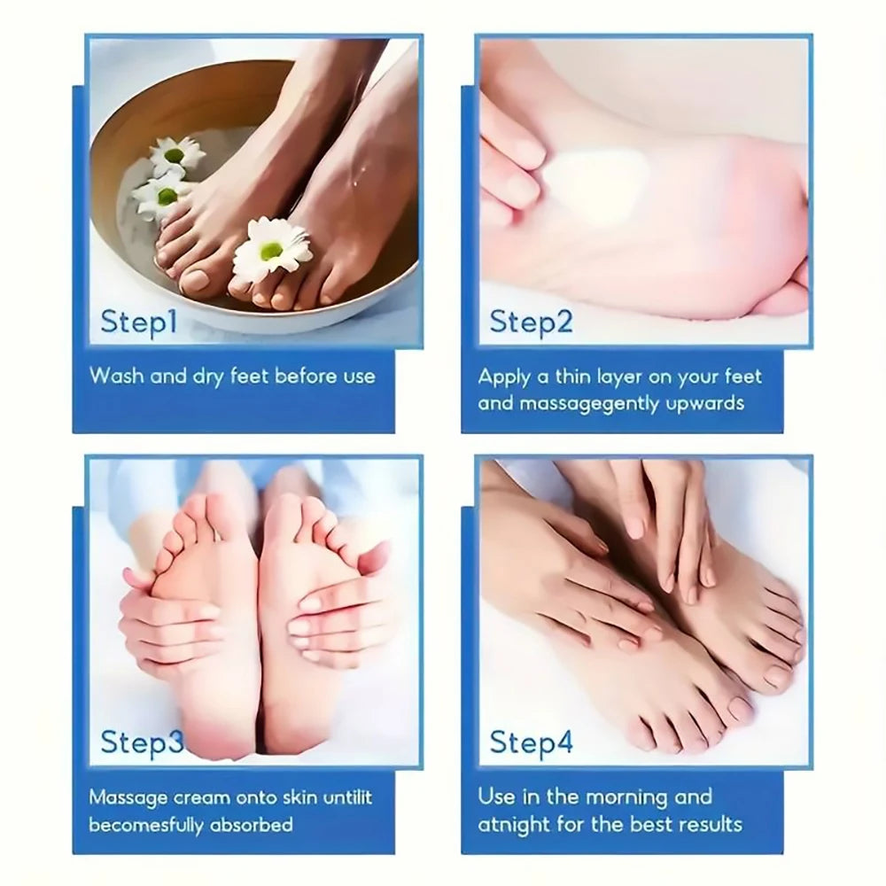60% Urea Foot Cream for Dry & Cracked Heels